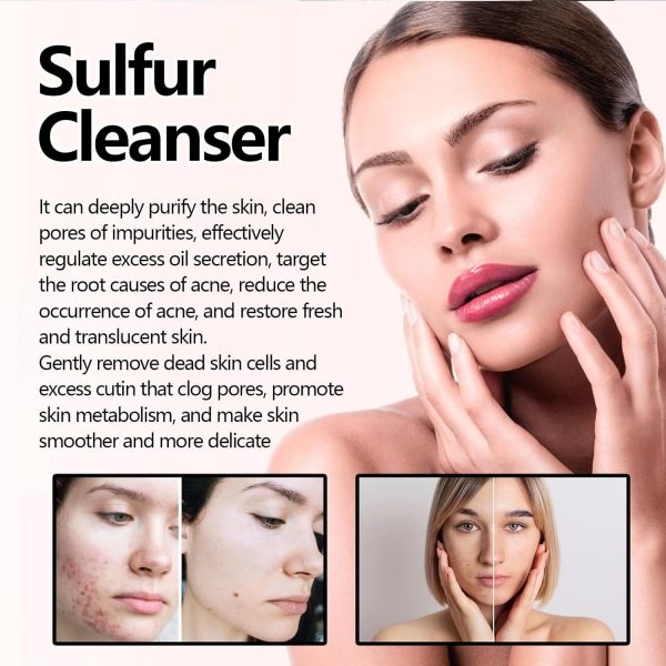 ⁦KASTWAVE Natural Sulfur Facial Cleanser, Exfoliating Facial Cleanser, Calms and Cools Redness and Discomfort, Reduces Oil Excess Pimples, Gently Cleanses, Refreshes & Makes Skin Radiant⁩ - الصورة ⁦3⁩