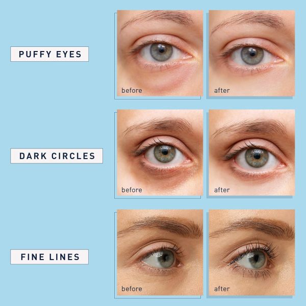 ⁦Enaskin Naturals Under Eye Patches for Dark Circles: 30 Pairs Retinol Collagen Eye Gels Mask - Reduce Wrinkles Puffy & Bags - Skin Treatment Pads - Anti Aging Moisturizer For Women Gift (Blue)⁩ - الصورة ⁦4⁩