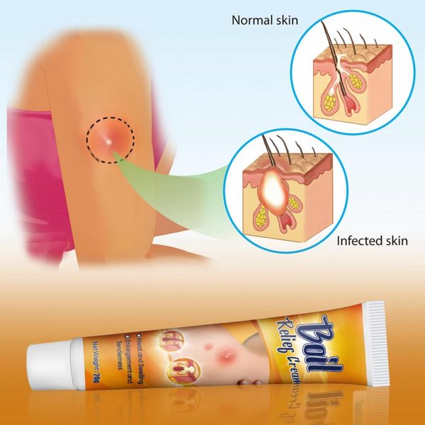 ⁦POSICHE Boil Relief Cream 20g Soothing Cream for Abscesses, Swelling, and Tenderness - Moisturizes & Calms Skin - Effective Relief for Boils & Abscesses, Gentle Care for Skin Health, Promotes Healing⁩ - الصورة ⁦6⁩