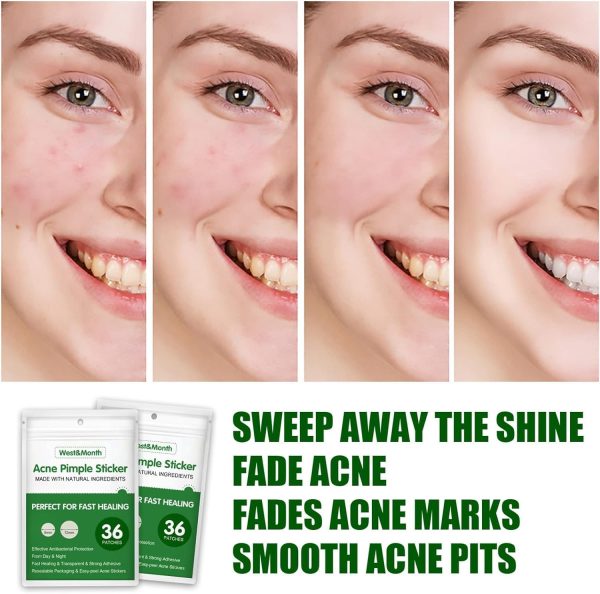 ⁦Salasabil Transparent Acne Remover Pimple Absorbing Cover Blemish Spot Skin Care Facial Stickers 2 Sizes (36 Count) in two boxs⁩ - الصورة ⁦7⁩