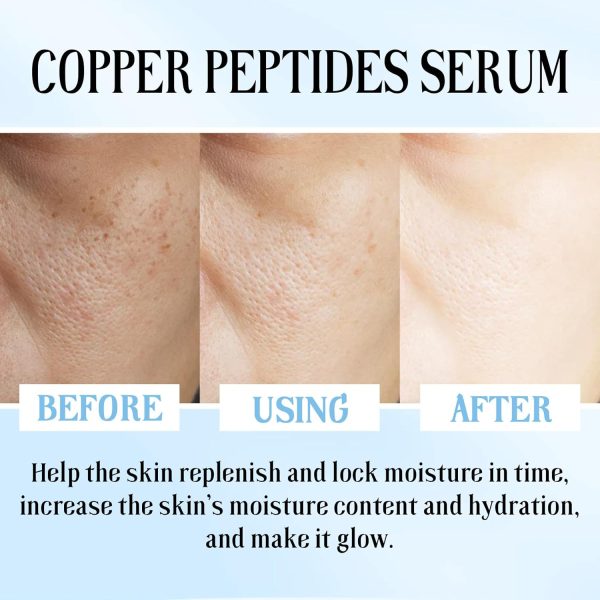 ⁦Mhepzol 2Pack Blue Copper Peptide Face Serums, Anti Wrinkle Improves Damaged Skin, Copper Peptides for Face, Glow Serum for Radiant, Hyaluronic Acid Serum Reduces Fine Lines, Improves Skin Barrier⁩ - الصورة ⁦4⁩