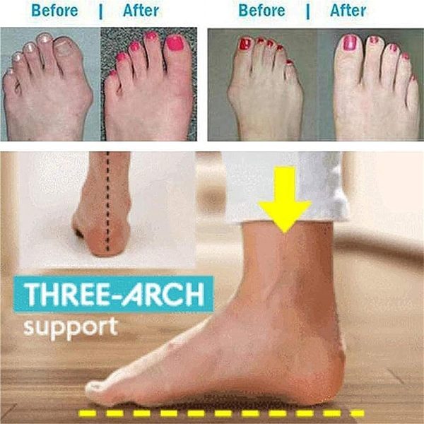 ⁦wuzhengzhijia Women's PU Leather Orthopedic Sandal, 39 EU⁩ - الصورة ⁦5⁩