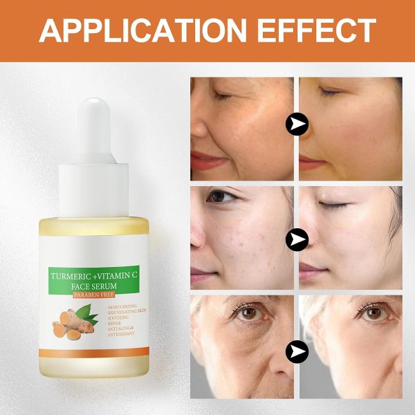 ⁦Turmeric Dark Spot Corrector Serum Turmeric and Vitamin C Serum for Face Dark Spot Correcting Glow Serum Dark Spot Remover for Face Tumeric Serum Acne Dark Spots Hyperpigmentation Smooth Skin 1oz⁩ - الصورة ⁦2⁩