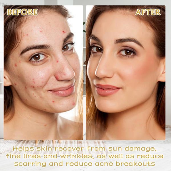⁦Azonee Kojic Acid and Turmeric Pads, 40PCS Turmeric Cleansing Pads, Deep Clean Pores Pads, Infused Cotton Exfoliating Pads, Turmeric Kojic Pads for Face, Helps Balance Skin Oil for All Skin Types⁩ - الصورة ⁦4⁩