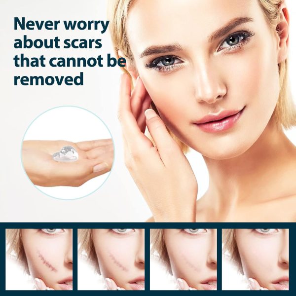 ⁦JDLYEVER Fade Scar Gel 50ml Surgical Scars Skin Hyperplasia Burning Nursing Care Smoothing Scars Repairing Scars, Moisturizing & Hydrating Ingredients Soothe & Nurture Skin, Non-Greasy All Skin Types⁩ - الصورة ⁦2⁩