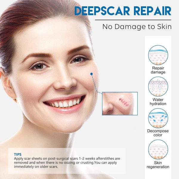 ⁦ALMEKAQUZ Silicone Scar Sheet, Scar Tape Roll (2.5CM*1.5M), Scars Hidder Strips, Professional Scar Removal Sheet for C-section, Surgery, Burns, Keloid, Acne⁩ - الصورة ⁦2⁩