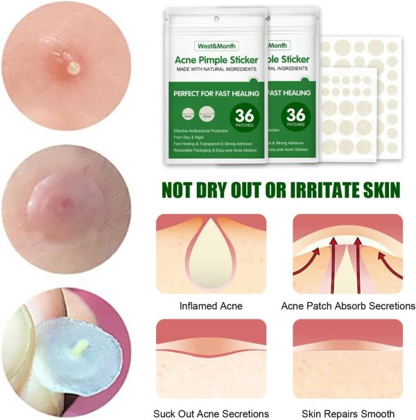 ⁦Salasabil Transparent Acne Remover Pimple Absorbing Cover Blemish Spot Skin Care Facial Stickers 2 Sizes (36 Count) in two boxs⁩ - الصورة ⁦4⁩