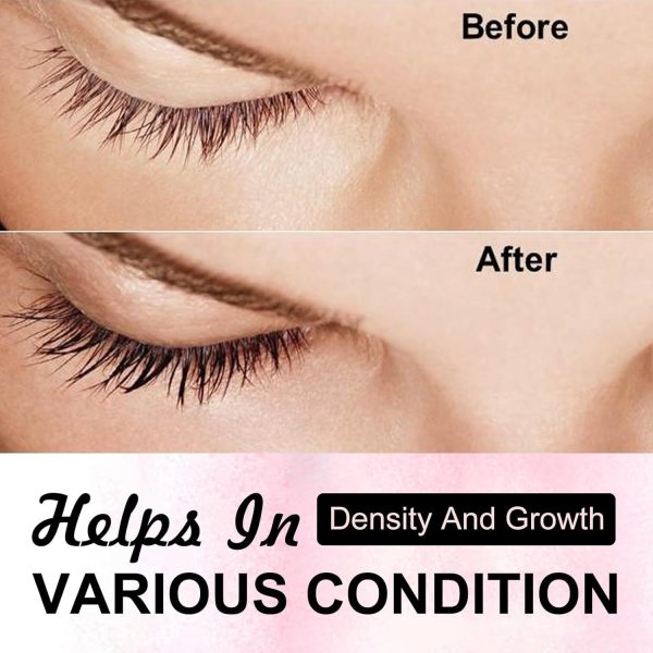 ⁦NALACAL Lash Serum for Eyelash and Eyebrow Growth, Lash Enhancing Serum with Advanced Formula to Boost Longer Fuller and Thicker Luscious Lashes, Hypoallergenic (3.5ml)⁩ - الصورة ⁦5⁩
