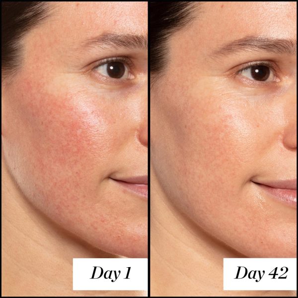 ⁦Sunday Riley A+ High-Dose Retinoid Serum, unscented, 1.7 Fl Oz⁩ - الصورة ⁦5⁩