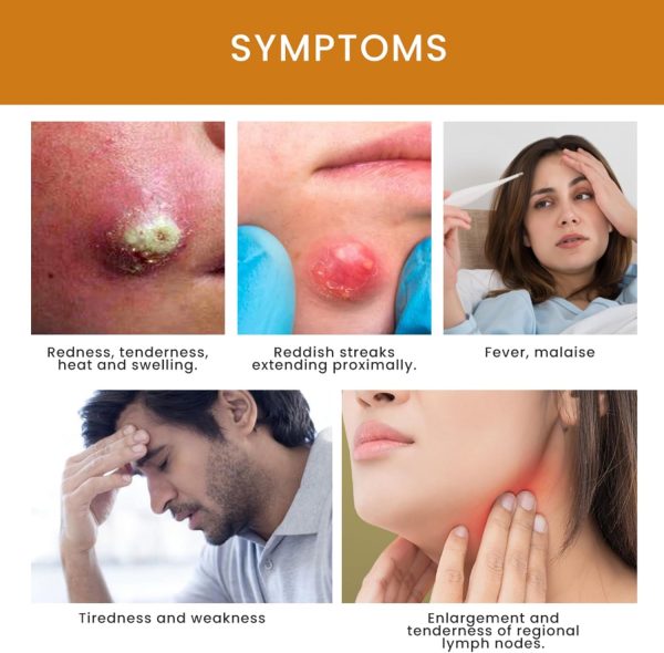 ⁦POSICHE Boil Relief Cream 20g Soothing Cream for Abscesses, Swelling, and Tenderness - Moisturizes & Calms Skin - Effective Relief for Boils & Abscesses, Gentle Care for Skin Health, Promotes Healing⁩ - الصورة ⁦7⁩