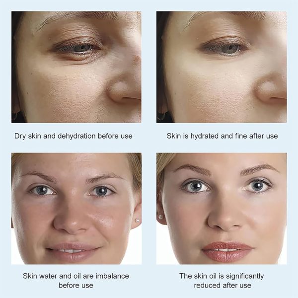 ⁦TERRIFI Hyaluronic Acid & B5 Face Toner, Hydrating Essence Water for Moisture and Skin Plumping, Smooths, Firms, and Lifts for Restored Elasticity and Reduced Dryness⁩ - الصورة ⁦6⁩