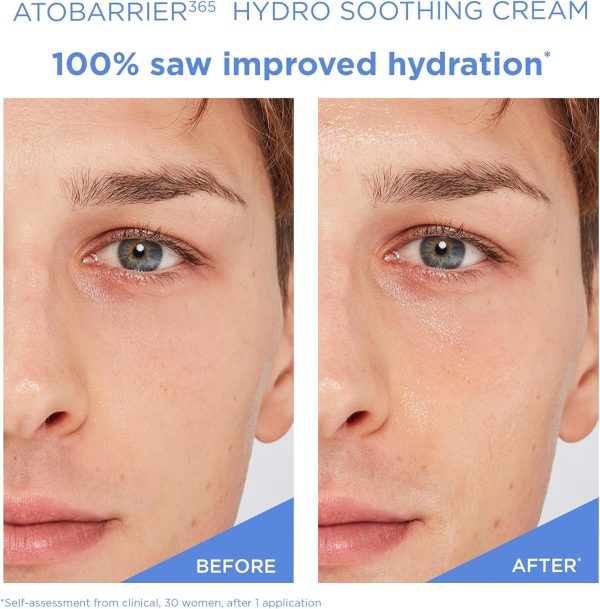 ⁦AESTURA ATOBARRIER365 Ceramide Hydro Soothing Cream | Lightweight Gel Moisturizer for Instant Cooling, Calming for Sensitive Skin, Quick Hydration, Non-comedogenic, 2.02 fl.oz.⁩ - الصورة ⁦5⁩