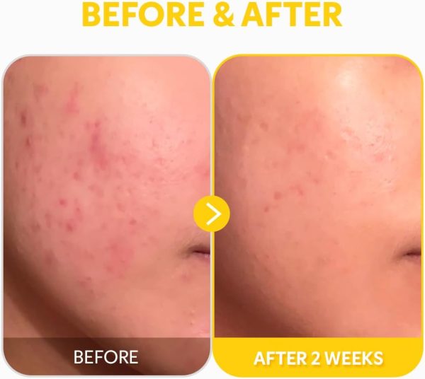 ⁦TIRTIR PURE VITAMIN C 24% SERUM 30ml⁩ - الصورة ⁦8⁩