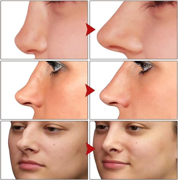 ⁦ERIKO LANUOP Nose Up Heighten Rhinoplasty Essential Oil - Charming Women Nose Repair Massage - Lift Up Care Beauty⁩ - الصورة ⁦3⁩