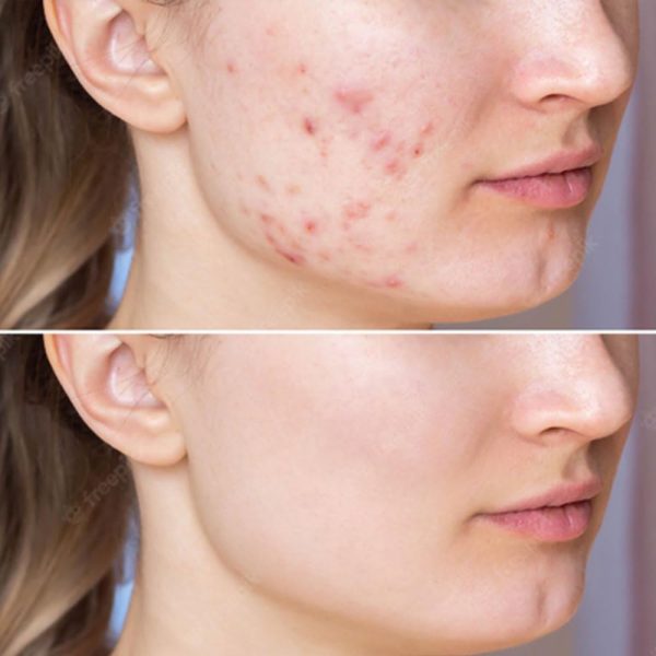 ⁦CARE:NEL Melasma Treatment for Face Cream - Dark Spot Remover Centella Asiatica - Korean Skin Care Beauty Products 40ml/1.35 fl.oz⁩ - الصورة ⁦6⁩
