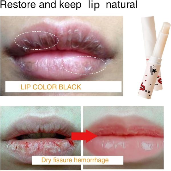 ⁦Lip Balm for Dry & Dark Lips - Hydrating & Softening Lip Treatment Balm, All-Day Moisturizer to Even Lip Tone, Nourishing Lip Care 5g⁩ - الصورة ⁦2⁩