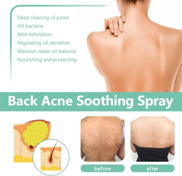 ⁦Azonee Clarifying Body Spray – With 2% Salicylic Acid & Tea Tree Oil, Refreshing Herbal Formula for Smooth & Balanced Skin, Fast-Absorbing & Non-Greasy Mist for Daily Skin Care (2Pcs)⁩ - الصورة ⁦3⁩
