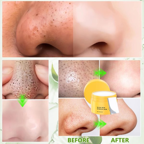 ⁦YOUSHEME 2pcs Pore Strips,Deep Cleansing Pore Strips,Nose Plants Blackhead Remover with 100 PCS Strips, Blackhead Remover Peel off Mask from Face & Nose⁩ - الصورة ⁦2⁩