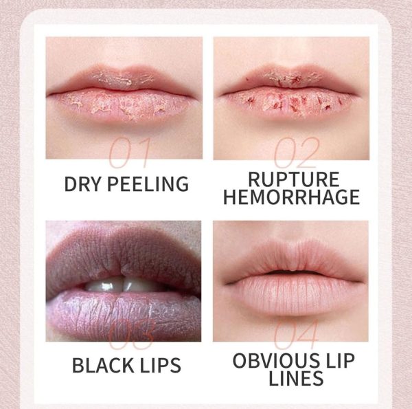 ⁦Lip Balm for Dry & Dark Lips - Hydrating & Softening Lip Treatment Balm, All-Day Moisturizer to Even Lip Tone, Nourishing Lip Care 5g⁩ - الصورة ⁦6⁩