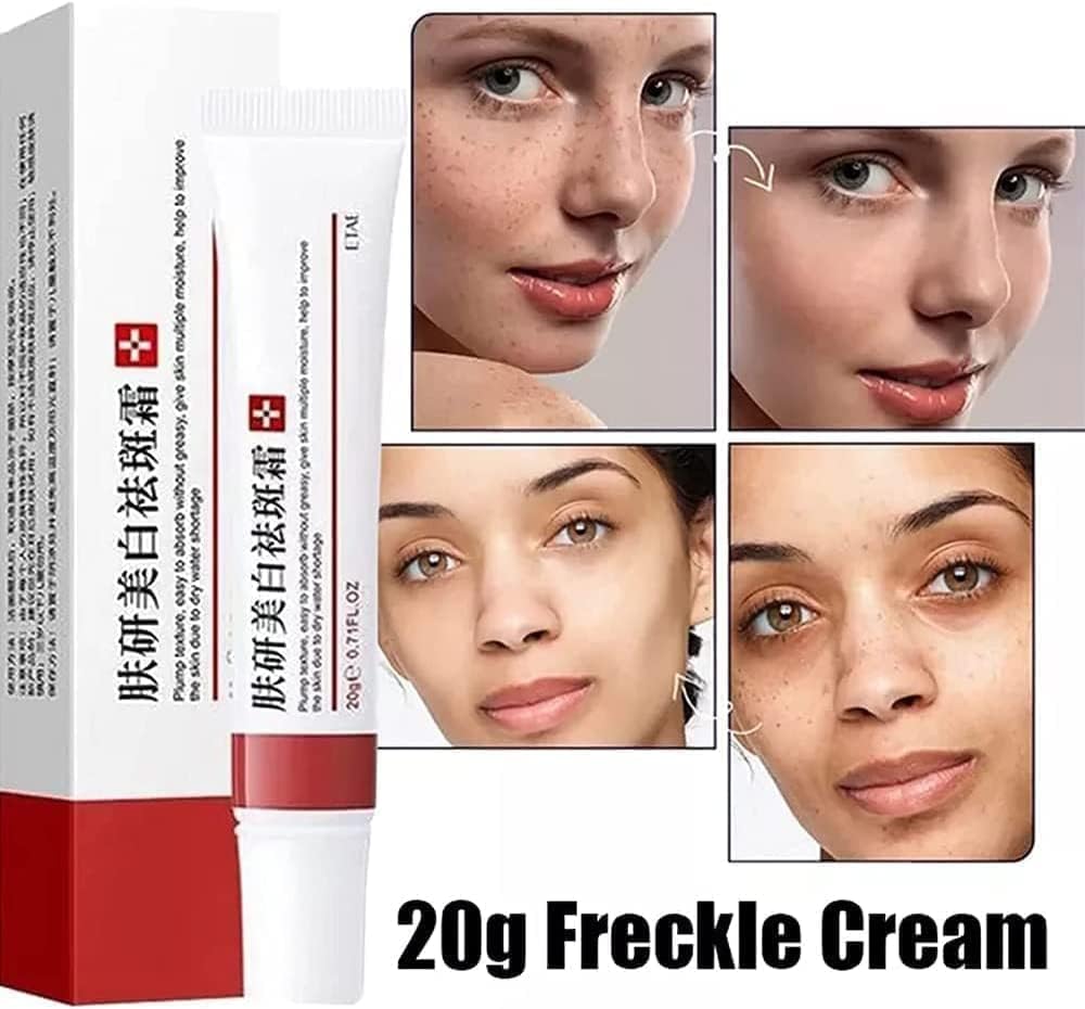 كريم تبييض النمش من دوهانشي، كريم ازالة تصبغ الوجه، كريم مزيل النمش، كريم مصحح البقع الداكنة للوجه والجسم يزيل التجاعيد والكلف وتصبغ (قطعتين) 5 كريم تبييض النمش من دوهانشي، كريم ازالة تصبغ الوجه، كريم مزيل النمش، كريم مصحح البقع الداكنة للوجه والجسم يزيل التجاعيد والكلف وتصبغ (قطعتين) - الصورة 5