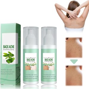 Azonee Clarifying Body Spray – With 2% Salicylic Acid & Tea Tree Oil, Refreshing Herbal Formula for Smooth & Balanced Skin, Fast-Absorbing & Non-Greasy Mist for Daily Skin Care (2Pcs)
