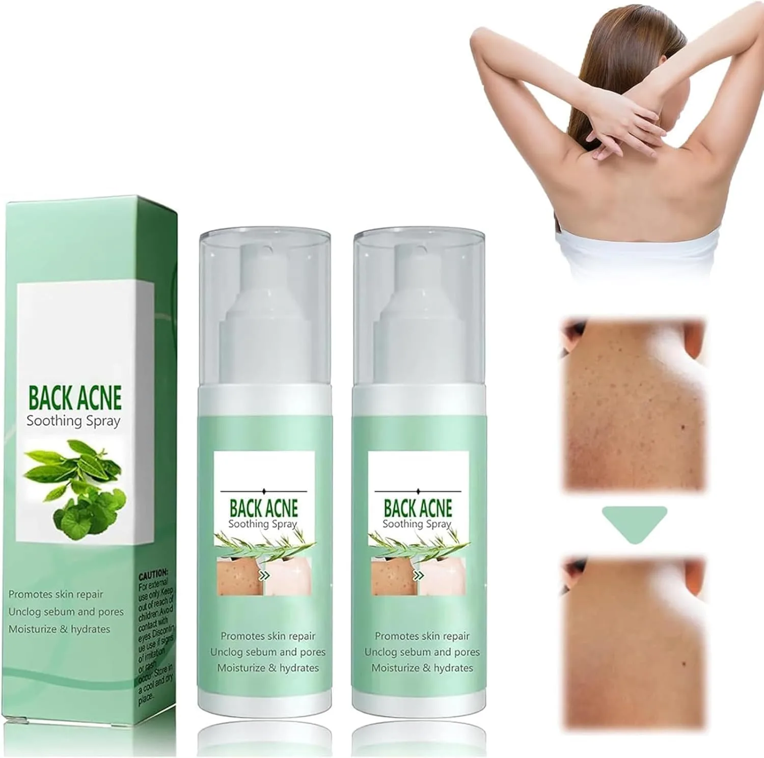 Azonee Clarifying Body Spray – With 2% Salicylic Acid & Tea Tree Oil, Refreshing Herbal Formula for Smooth & Balanced Skin, Fast-Absorbing & Non-Greasy Mist for Daily Skin Care (2Pcs)