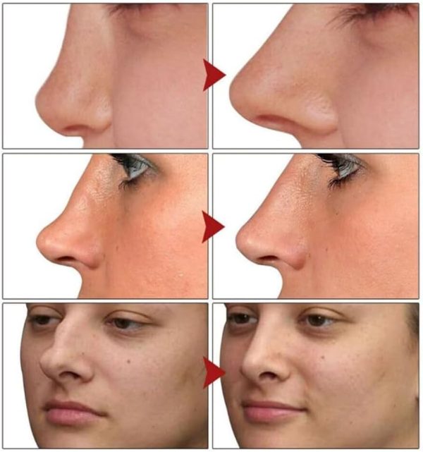 ⁦Azonee Nose Defining Serum, Sci-Effect Nose Lift Shaping Oil, Nasal Bone Remodeling Serum, Contouring Nose Lift Up Shaping Essence Oil (1 Pcs)⁩ - الصورة ⁦3⁩