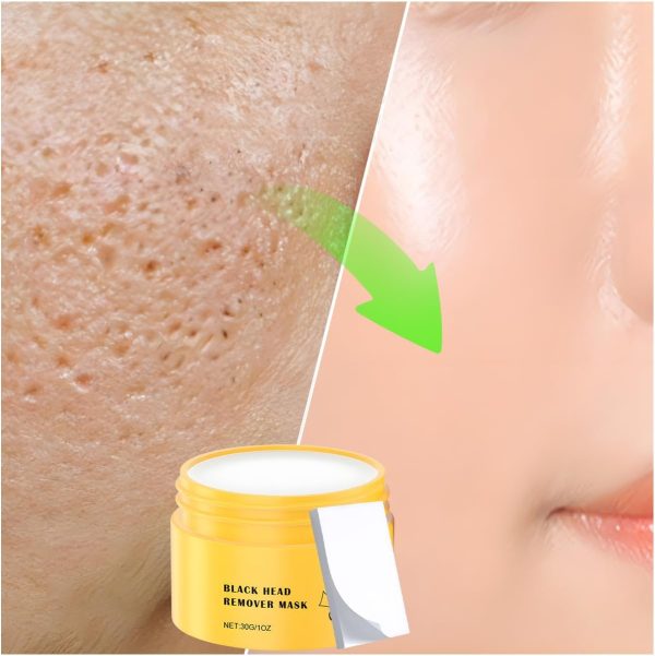 ⁦YOUSHEME 2pcs Pore Strips,Deep Cleansing Pore Strips,Nose Plants Blackhead Remover with 100 PCS Strips, Blackhead Remover Peel off Mask from Face & Nose⁩ - الصورة ⁦3⁩