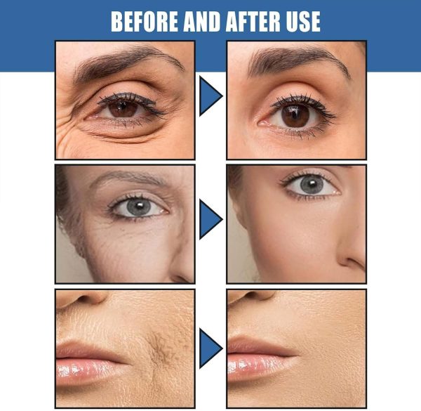 ⁦Anti-Aging Face Cream,5 Seconds Instant Wrinkle Removal Cream,with 2.5% Retinol Anti-Wrinkle Cream Skin Firming Lifting Moisturizing Facial Cream Remove Fine Line Skin Care⁩ - الصورة ⁦5⁩