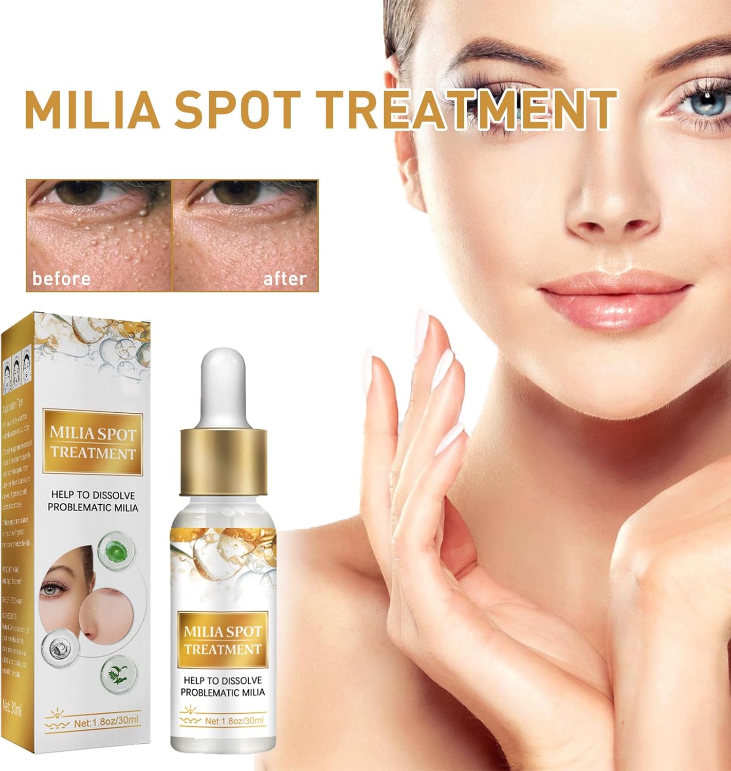 Milia Removal Spot Care,Fat Particle Eye Serum,Eye Serum for Dark Circles Puffiness,Milia Spot Reduce Face Serums,Milia Treatment Spot Remover for Face,30ml,including Cotton Pads Makeup 2 Milia Removal Spot Care,Fat Particle Eye Serum,Eye Serum for Dark Circles Puffiness,Milia Spot Reduce Face Serums,Milia Treatment Spot Remover for Face,30ml,including Cotton Pads Makeup - الصورة 2