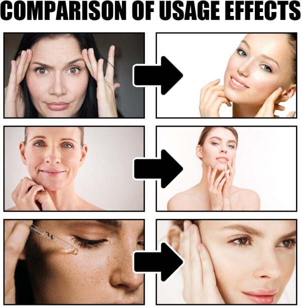 ⁦Azonee Boto Face Serum for Women, Anti-Aging Boto Stock Solution B5, 30ml Hydrating Serum for Women, Reduces Fine Lines and Wrinkles, Plumps and Hydrates Skin⁩ - الصورة ⁦6⁩