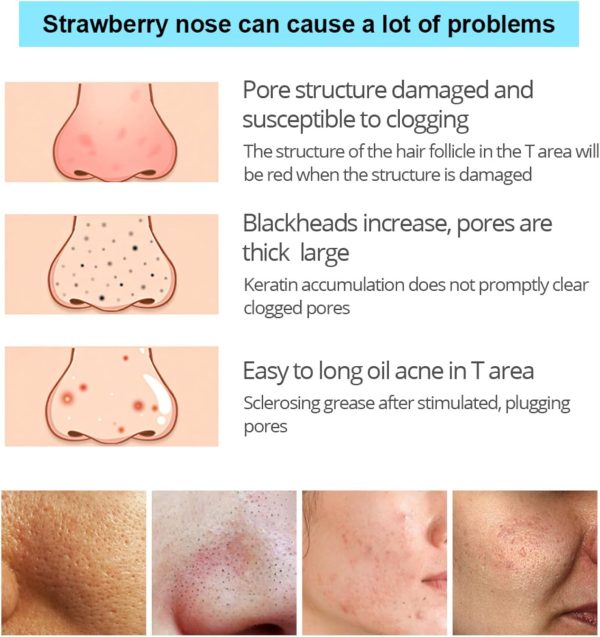 ⁦JDLYEVER Bamboo Charcoal Blackhead Mask Shrinks Pores Deep Cleansing Helps to Extract Dirt & Oil, Blackhead Removal Peel-Off Design Easy to Apply Suitable for All Skin Types Refreshing Scent⁩ - الصورة ⁦5⁩