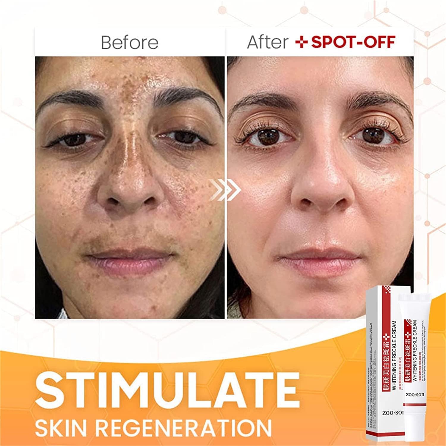 كريم تبييض النمش من دوهانشي، كريم ازالة تصبغ الوجه، كريم مزيل النمش، كريم مصحح البقع الداكنة للوجه والجسم يزيل التجاعيد والكلف وتصبغ (قطعتين) 4 كريم تبييض النمش من دوهانشي، كريم ازالة تصبغ الوجه، كريم مزيل النمش، كريم مصحح البقع الداكنة للوجه والجسم يزيل التجاعيد والكلف وتصبغ (قطعتين) - الصورة 4