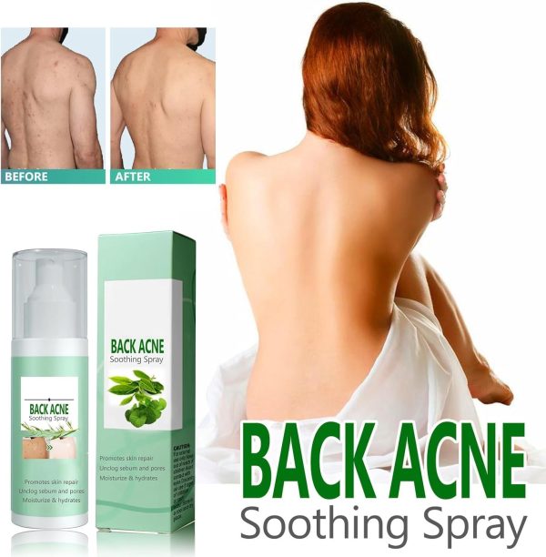 ⁦Azonee Clarifying Body Spray – With 2% Salicylic Acid & Tea Tree Oil, Refreshing Herbal Formula for Smooth & Balanced Skin, Fast-Absorbing & Non-Greasy Mist for Daily Skin Care (2Pcs)⁩ - الصورة ⁦2⁩