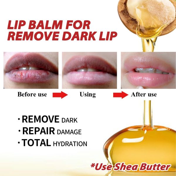 ⁦Lip Balm for Dry & Dark Lips - Hydrating & Softening Lip Treatment Balm, All-Day Moisturizer to Even Lip Tone, Nourishing Lip Care 5g⁩ - الصورة ⁦4⁩