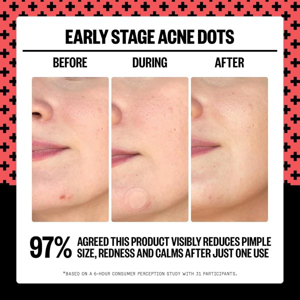 ⁦PEACE OUT Early Stage Acne Dots Helps Target Blemishes Below the Surface, Hydrocolloid Pimple Patches Minimize Bumps Before They Appear with Dissolving Microneedles, Salicylic Acid, 8 Count⁩ - الصورة ⁦3⁩