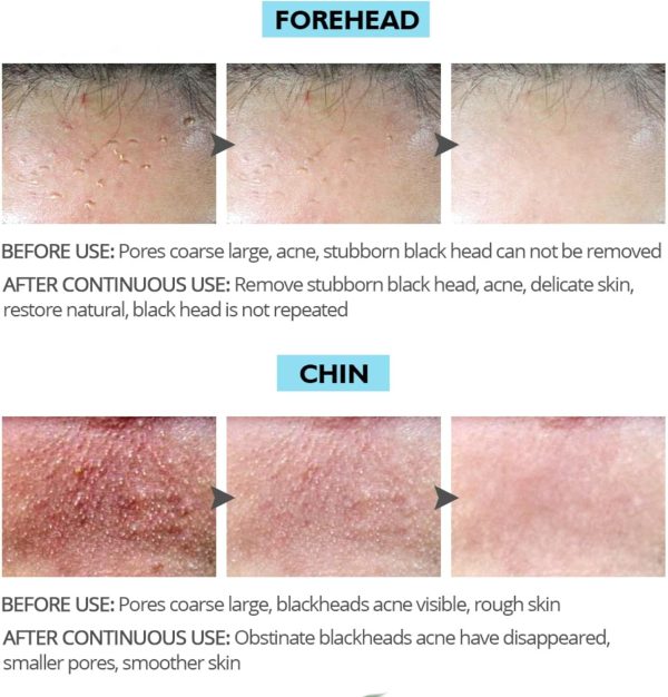 ⁦JDLYEVER Bamboo Charcoal Blackhead Mask Shrinks Pores Deep Cleansing Helps to Extract Dirt & Oil, Blackhead Removal Peel-Off Design Easy to Apply Suitable for All Skin Types Refreshing Scent⁩ - الصورة ⁦8⁩