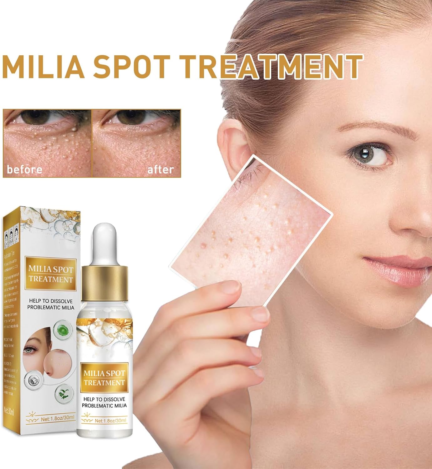 Milia Removal Spot Care,Fat Particle Eye Serum,Eye Serum for Dark Circles Puffiness,Milia Spot Reduce Face Serums,Milia Treatment Spot Remover for Face,30ml,including Cotton Pads Makeup 3 Milia Removal Spot Care,Fat Particle Eye Serum,Eye Serum for Dark Circles Puffiness,Milia Spot Reduce Face Serums,Milia Treatment Spot Remover for Face,30ml,including Cotton Pads Makeup - الصورة 3