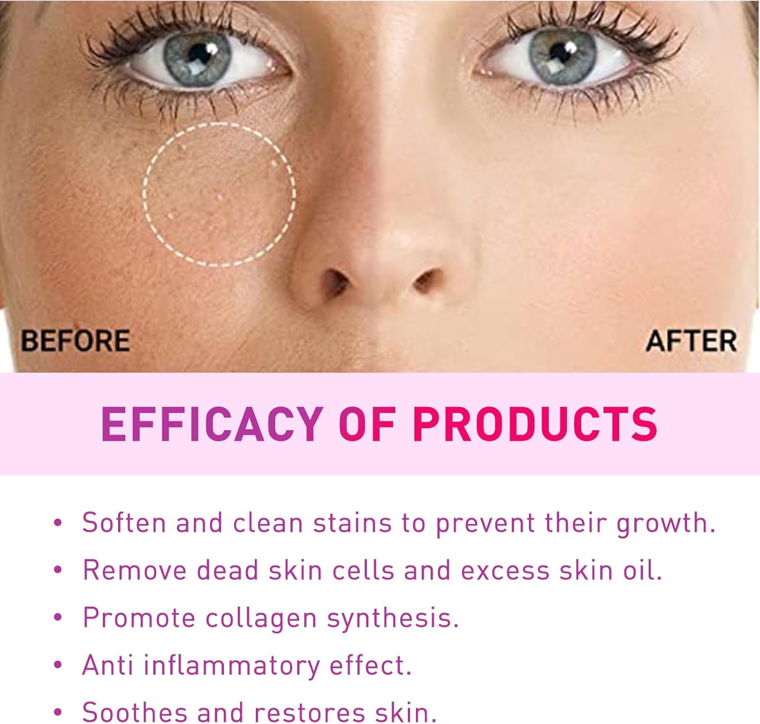 Milia Removal Spot Care,Fat Particle Eye Serum,Eye Serum for Dark Circles Puffiness,Milia Spot Reduce Face Serums,Milia Treatment Spot Remover for Face,30ml,including Cotton Pads Makeup 5 Milia Removal Spot Care,Fat Particle Eye Serum,Eye Serum for Dark Circles Puffiness,Milia Spot Reduce Face Serums,Milia Treatment Spot Remover for Face,30ml,including Cotton Pads Makeup - الصورة 5