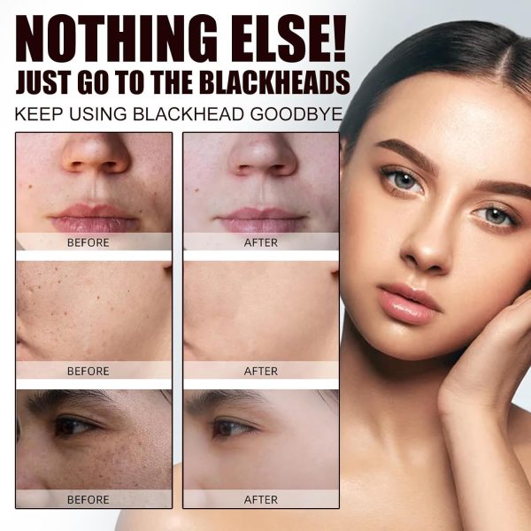 ⁦Mazinreem Black Tea Extract Cleansing Mask - Black Tea Face Mask, Extract Cleansing Mask, Lift and firm skin, Reduce fine lines & acne, Eliminate age spots, Remove blackheads, Black Tea Mask⁩ - الصورة ⁦7⁩