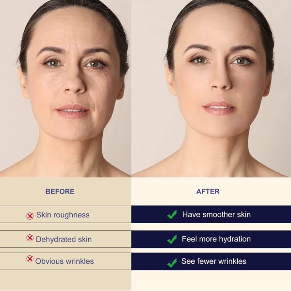 ⁦11 Pcs Forehead Wrinkle Patches for Women,Frownies Forehead Facial Patches Anti Wrinkle Tape⁩ - الصورة ⁦3⁩