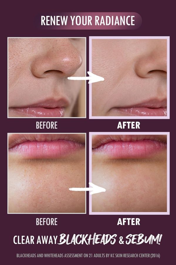 ⁦DERMALOGY by NEOGENLAB NEOGEN PORE TIGHT PEELING MOUSSE 2.7 oz / 80ml⁩ - الصورة ⁦4⁩