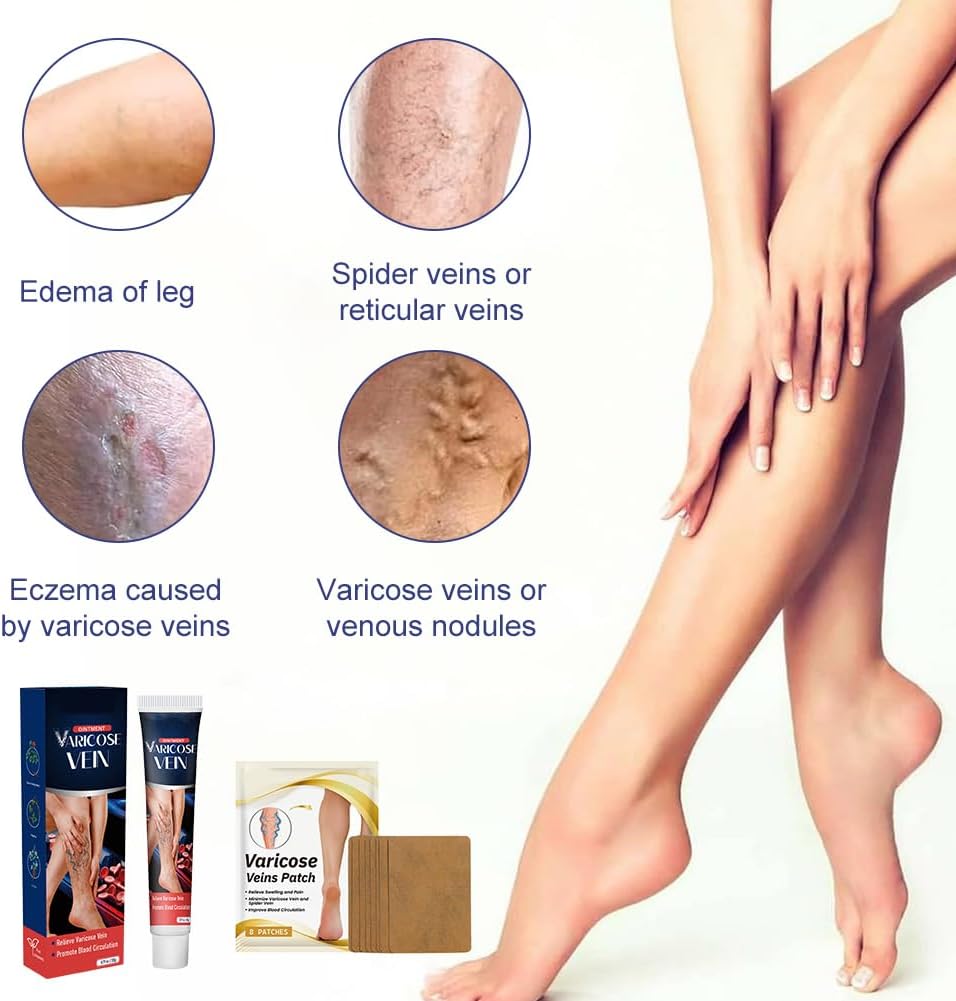 Varicose Veins Cream, Varicose Veins Ointment, Strengthening Capillary Health, Improving Blood Circulation 5 Varicose Veins Cream, Varicose Veins Ointment, Strengthening Capillary Health, Improving Blood Circulation - الصورة 5