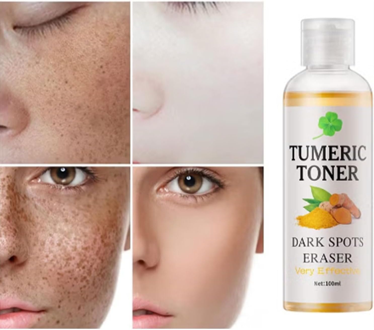 Makbeaty 100ml Facial Toner for Acne Prone Skin, Blemish Removing Facial Moisturizer for Women, The natural ingredients can clear up acne, lighten dark spots, minimize pores, control oil. 3 Makbeaty 100ml Facial Toner for Acne Prone Skin, Blemish Removing Facial Moisturizer for Women, The natural ingredients can clear up acne, lighten dark spots, minimize pores, control oil. - الصورة 3