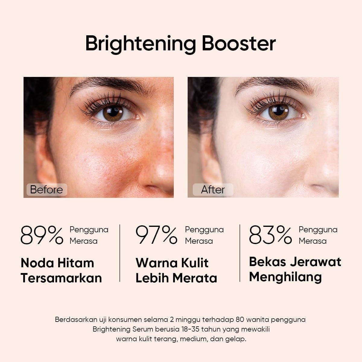 Skintevic Skin Care Kit, Mud Mask, Truffle Cream, Moisturizing Gel with Ceramides, Salicylic Acid Serum, Niacinamide Serum for Skin Barrier Prevention and Removal of Pimples and Acne Toning 5 Skintevic Skin Care Kit, Mud Mask, Truffle Cream, Moisturizing Gel with Ceramides, Salicylic Acid Serum, Niacinamide Serum for Skin Barrier Prevention and Removal of Pimples and Acne Toning - الصورة 5