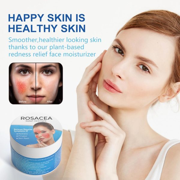 ⁦JDLYEVER Rosacea Relief Ointment 100g Soothing Skin Care Cream for Redness and Inflammation, Effective Treatment for Rosacea, Acne, and Dermatitis, Calms Flushing and Blemishes, for Daily Facial Care⁩ - الصورة ⁦3⁩