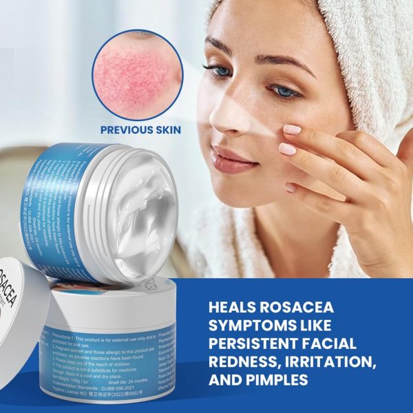 ⁦JDLYEVER Rosacea Relief Ointment 100g Soothing Skin Care Cream for Redness and Inflammation, Effective Treatment for Rosacea, Acne, and Dermatitis, Calms Flushing and Blemishes, for Daily Facial Care⁩ - الصورة ⁦4⁩