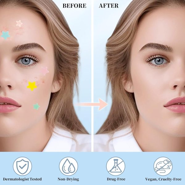 ⁦200Pcs Acne Pimple Patches, Hydrocolloid Acne Patch,Pimple Patches for Face, Colorful Star Pimple Spot Sticker with Hyaluronic Acid, for Covering Zits and Blemishes⁩ - الصورة ⁦5⁩
