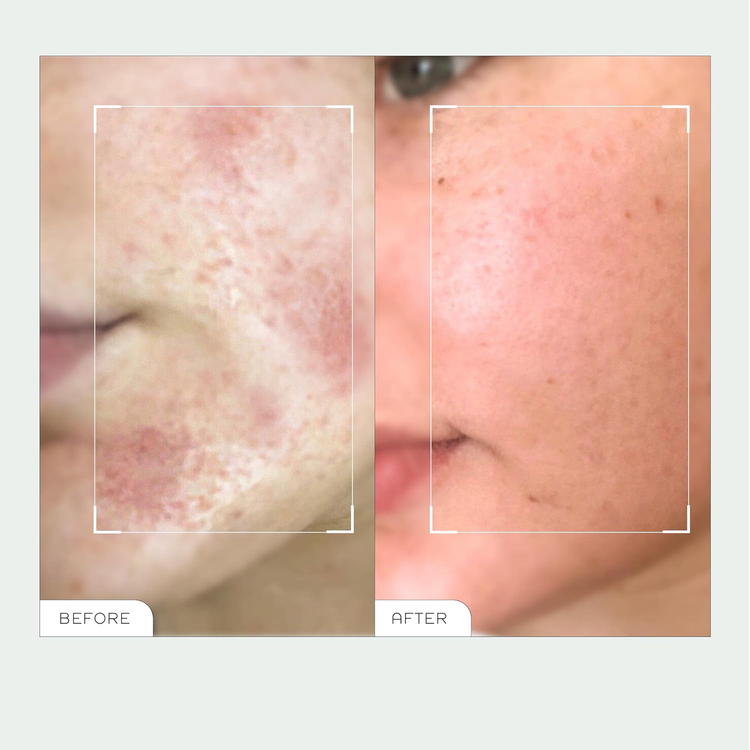 REN Clean Skincare Evercalm(tm) Overnight Recovery Balm, Travel Size 15ml 4 REN Clean Skincare Evercalm(tm) Overnight Recovery Balm, Travel Size 15ml - الصورة 4