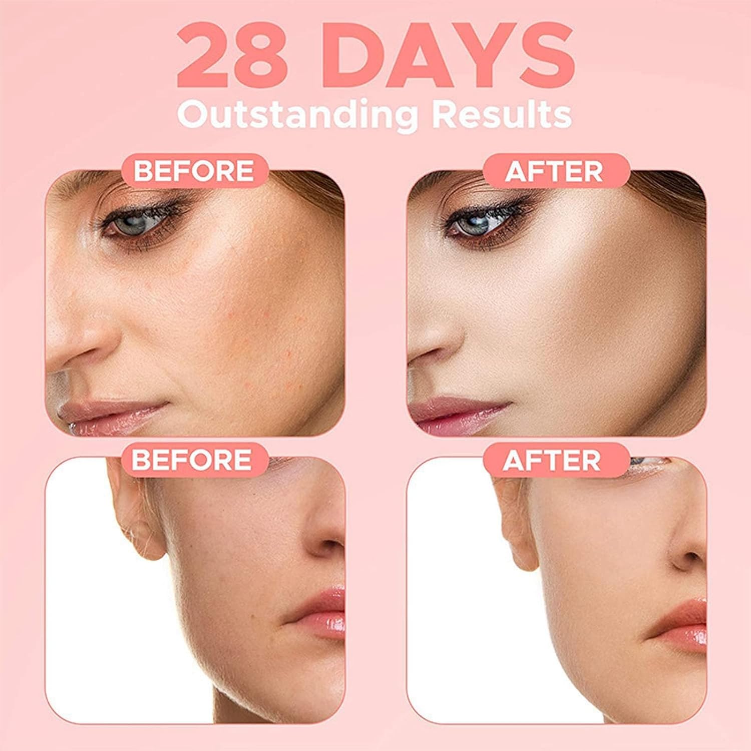 Azonee Collagen Face Serum, 4-in-1 Anti-Aging Serum for Firming, Hydrating, Oil Control & Wrinkle Reduction, Youthful Glow with Vitamin B3 & Tremella Extract (1 Fl Oz) 3 Azonee Collagen Face Serum, 4-in-1 Anti-Aging Serum for Firming, Hydrating, Oil Control & Wrinkle Reduction, Youthful Glow with Vitamin B3 & Tremella Extract (1 Fl Oz) - الصورة 3